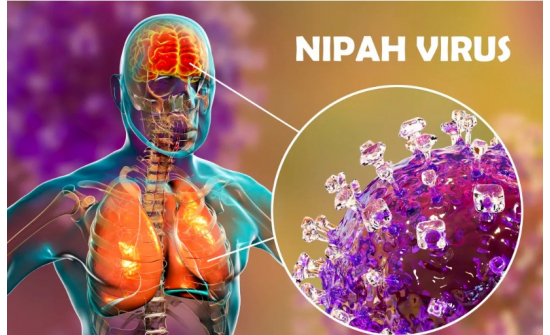 "NIPAH" ВИРУСИЙН ХАЛДВАРААС СЭРЭМЖЛЭХ СЭРЭМЖЛҮҮЛЭГ!